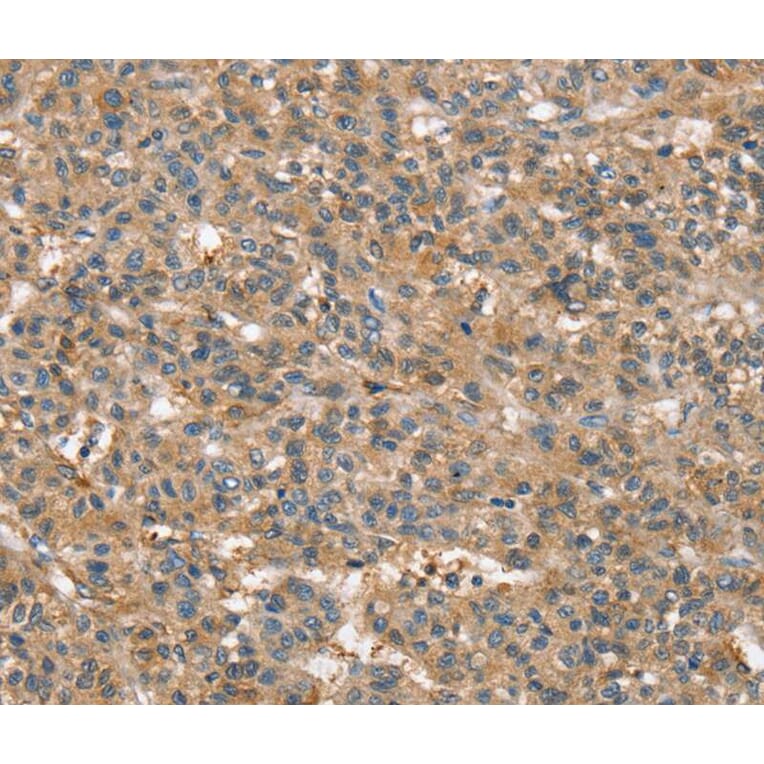 Immunohistochemistry - SSX2IP Antibody from Signalway Antibody (40119) - Antibodies.com