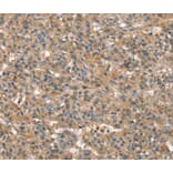Immunohistochemistry - SSX2IP Antibody from Signalway Antibody (40119) - Antibodies.com