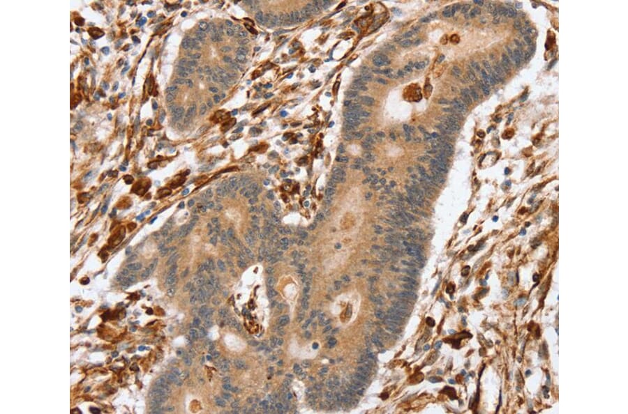 Immunohistochemistry - SSX2IP Antibody from Signalway Antibody (40119) - Antibodies.com