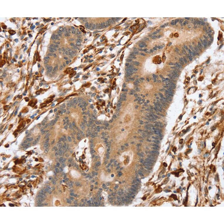 Immunohistochemistry - SSX2IP Antibody from Signalway Antibody (40119) - Antibodies.com