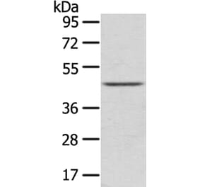 LEFTY2 Antibody from Signalway Antibody (40140) - Antibodies.com