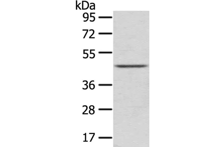 LEFTY2 Antibody from Signalway Antibody (40140) - Antibodies.com