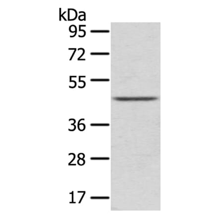 LEFTY2 Antibody from Signalway Antibody (40140) - Antibodies.com