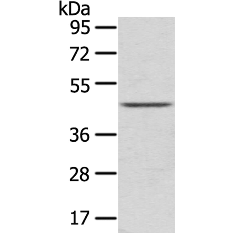 LEFTY2 Antibody from Signalway Antibody (40140) - Antibodies.com