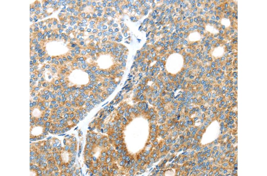 Immunohistochemistry - LEFTY2 Antibody from Signalway Antibody (40140) - Antibodies.com