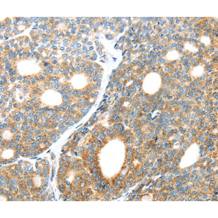 Immunohistochemistry - LEFTY2 Antibody from Signalway Antibody (40140) - Antibodies.com