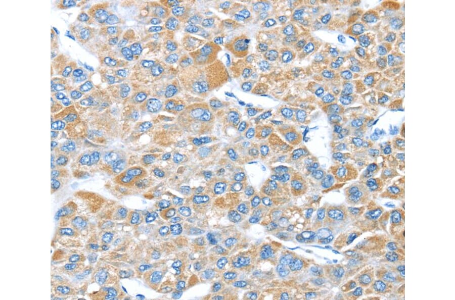 Immunohistochemistry - LEFTY2 Antibody from Signalway Antibody (40140) - Antibodies.com