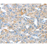 Immunohistochemistry - LEFTY2 Antibody from Signalway Antibody (40140) - Antibodies.com