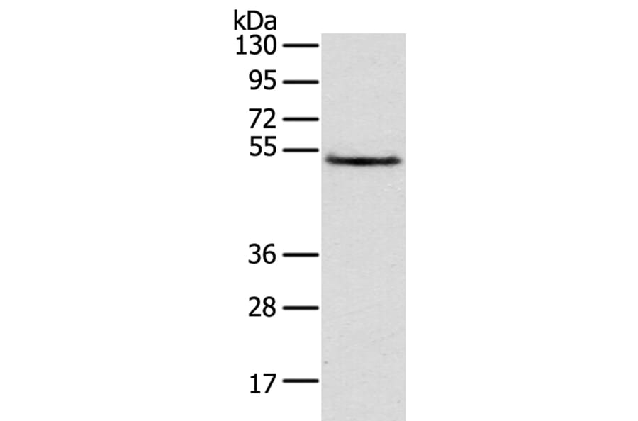 TRIM14 Antibody from Signalway Antibody (40149) - Antibodies.com