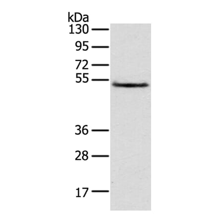 TRIM14 Antibody from Signalway Antibody (40149) - Antibodies.com