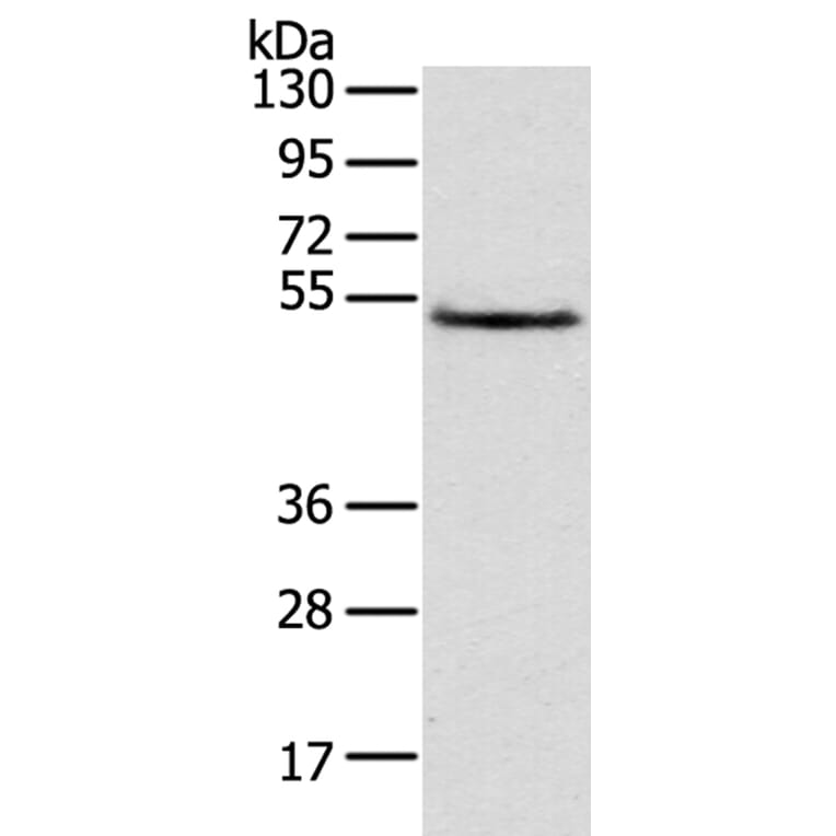 TRIM14 Antibody from Signalway Antibody (40149) - Antibodies.com