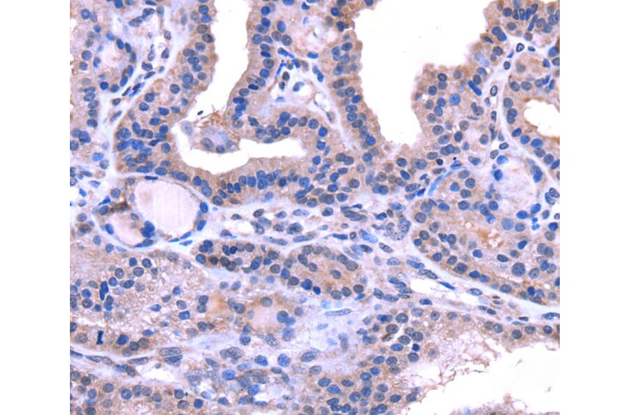 Immunohistochemistry - TRIM14 Antibody from Signalway Antibody (40149) - Antibodies.com