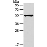 TRIM10 Antibody from Signalway Antibody (40150) - Antibodies.com