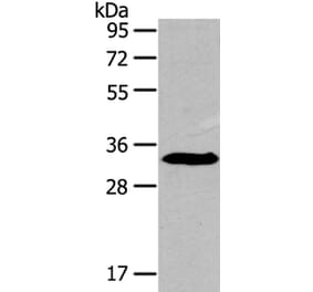IGFBP3 Antibody from Signalway Antibody (40184) - Antibodies.com