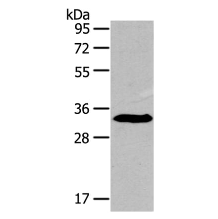 IGFBP3 Antibody from Signalway Antibody (40184) - Antibodies.com