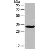 IGFBP3 Antibody from Signalway Antibody (40184) - Antibodies.com