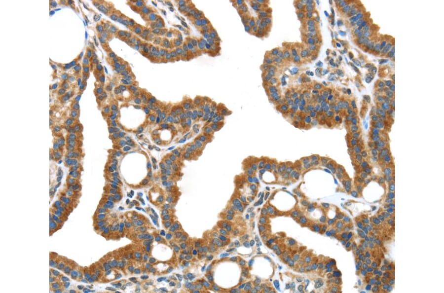 Immunohistochemistry - IGFBP3 Antibody from Signalway Antibody (40184) - Antibodies.com