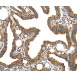 Immunohistochemistry - IGFBP3 Antibody from Signalway Antibody (40184) - Antibodies.com