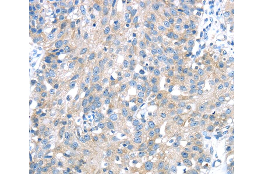 Immunohistochemistry - IGFBP3 Antibody from Signalway Antibody (40184) - Antibodies.com
