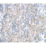 Immunohistochemistry - IGFBP3 Antibody from Signalway Antibody (40184) - Antibodies.com