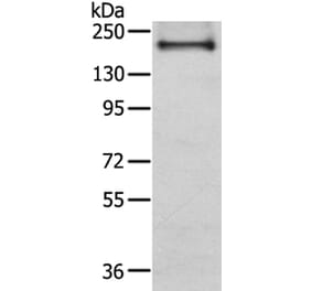 IQGAP2 Antibody from Signalway Antibody (40187) - Antibodies.com