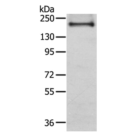 IQGAP2 Antibody from Signalway Antibody (40187) - Antibodies.com