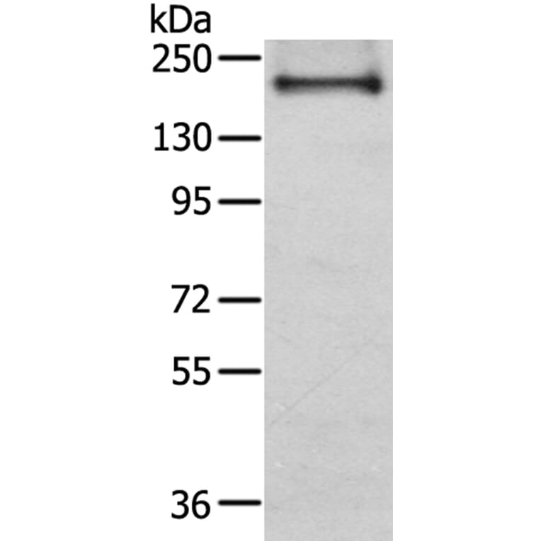 IQGAP2 Antibody from Signalway Antibody (40187) - Antibodies.com