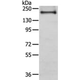 IQGAP2 Antibody from Signalway Antibody (40187) - Antibodies.com