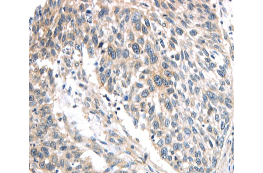 Immunohistochemistry - IQGAP2 Antibody from Signalway Antibody (40187) - Antibodies.com