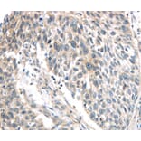 Immunohistochemistry - IQGAP2 Antibody from Signalway Antibody (40187) - Antibodies.com