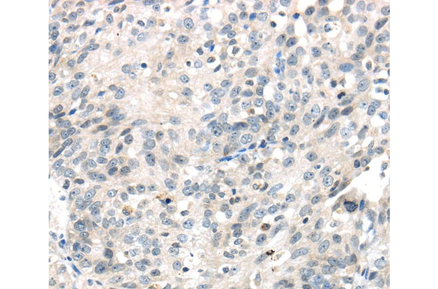 Immunohistochemistry - IQGAP2 Antibody from Signalway Antibody (40187) - Antibodies.com
