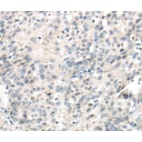 Immunohistochemistry - IQGAP2 Antibody from Signalway Antibody (40187) - Antibodies.com