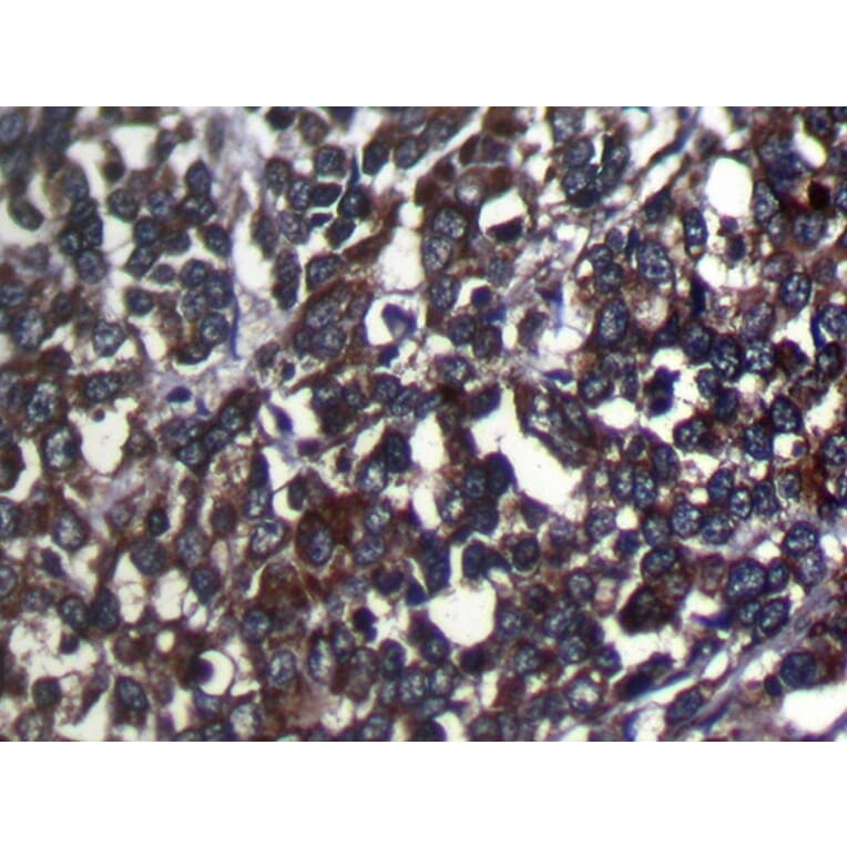 Immunohistochemistry - SRGAP1 Antibody from Signalway Antibody (40222) - Antibodies.com