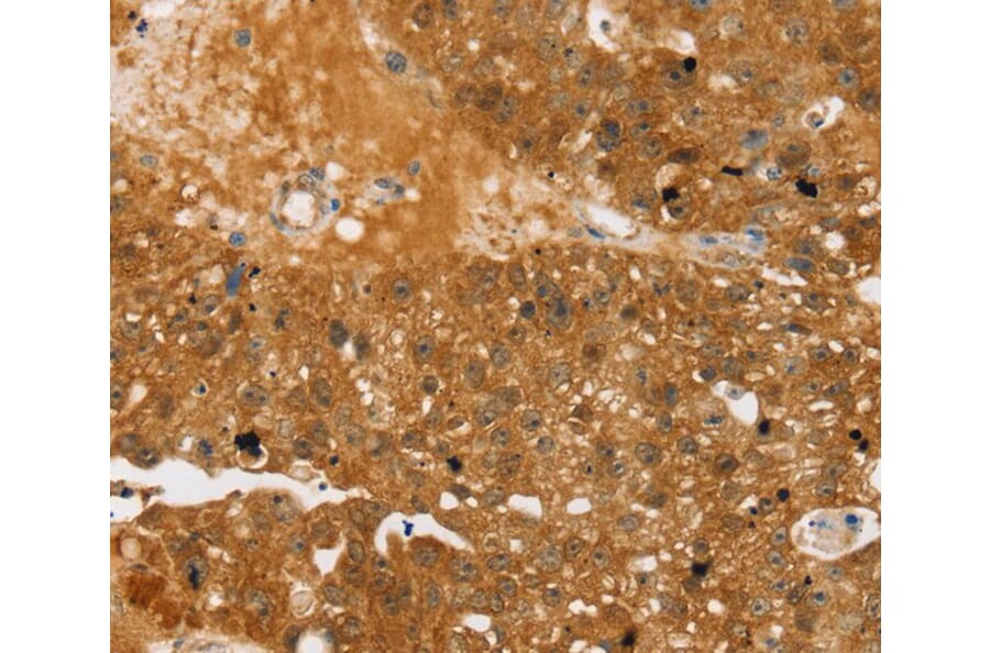 Immunohistochemistry - TBC1D4 Antibody from Signalway Antibody (40237) - Antibodies.com