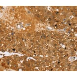 Immunohistochemistry - TBC1D4 Antibody from Signalway Antibody (40237) - Antibodies.com