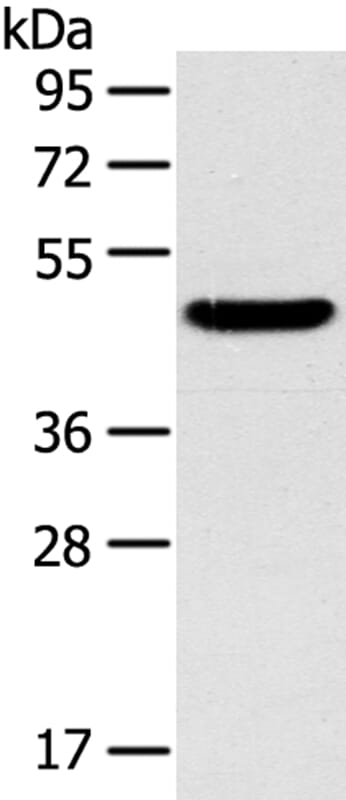 Gel: 8% SDS-PAGE Lysate: 40ug Mouse liver tissue. Primary antibody: 1/400 dilution Secondary antibody dilution: 1/8000Exposure time: 1 minute