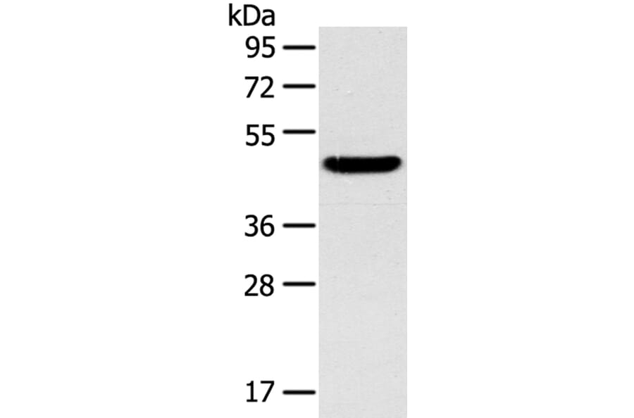 TM7SF2 Antibody from Signalway Antibody (40251) - Antibodies.com