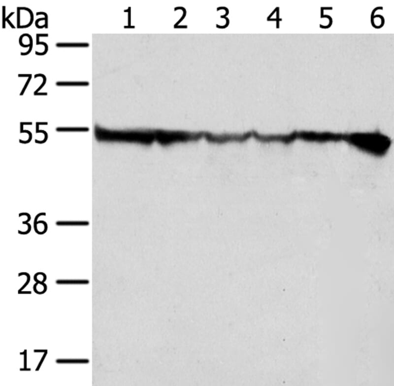 Gel: 8% SDS-PAGE Lysates (from left to right): Hela, hepg2, Jurkat, 231, SKOV3 and 293T cell. Amount of lysate: 40ug per lane Primary antibody: 1/200 dilution Secondary antibody dilution: 1/8000Exposure time: 1 second
