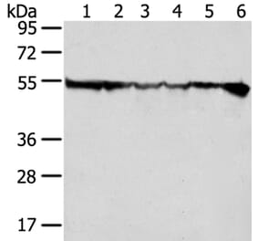 DDX39B Antibody from Signalway Antibody (40275) - Antibodies.com