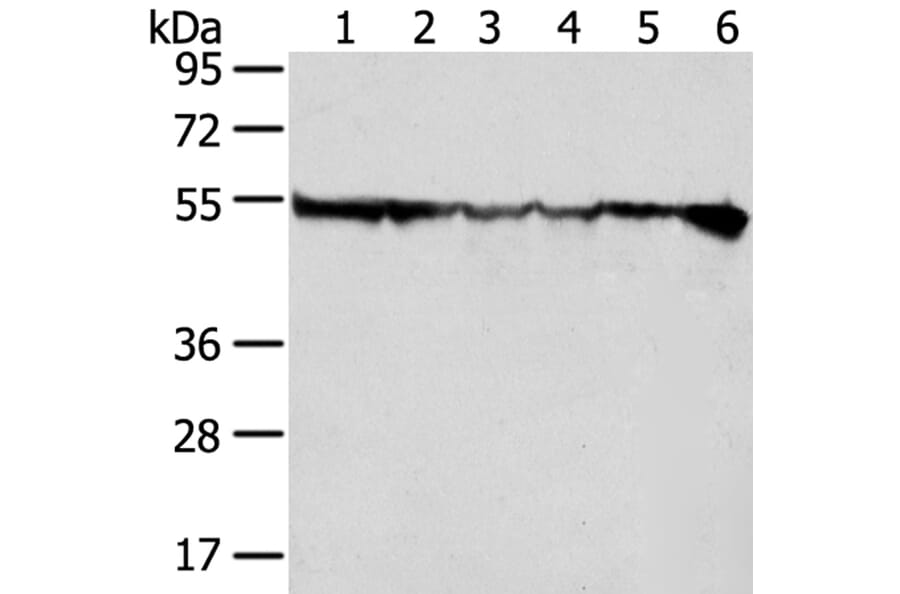 DDX39B Antibody from Signalway Antibody (40275) - Antibodies.com