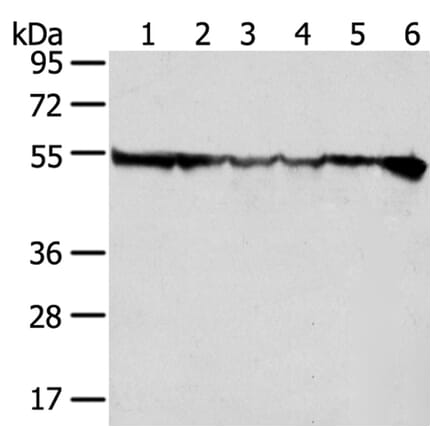 DDX39B Antibody from Signalway Antibody (40275) - Antibodies.com