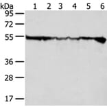DDX39B Antibody from Signalway Antibody (40275) - Antibodies.com