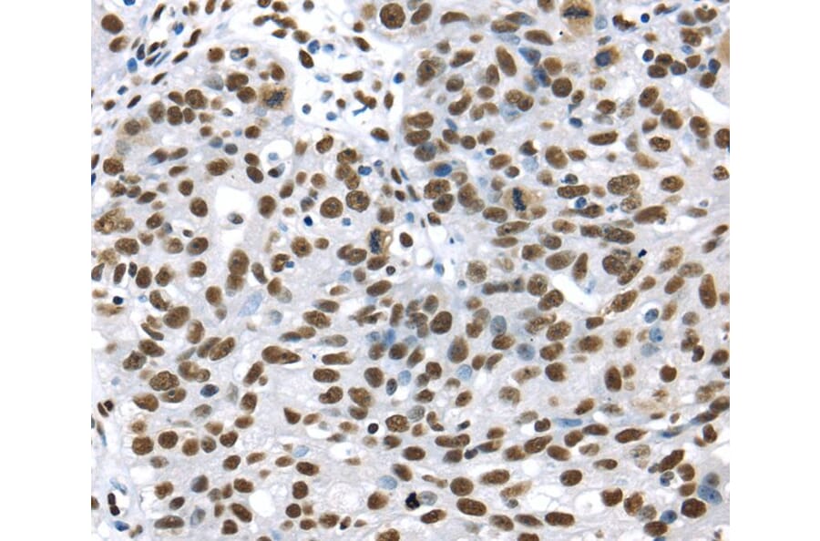 Immunohistochemistry - DDX39B Antibody from Signalway Antibody (40275) - Antibodies.com