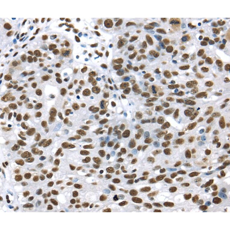 Immunohistochemistry - DDX39B Antibody from Signalway Antibody (40275) - Antibodies.com