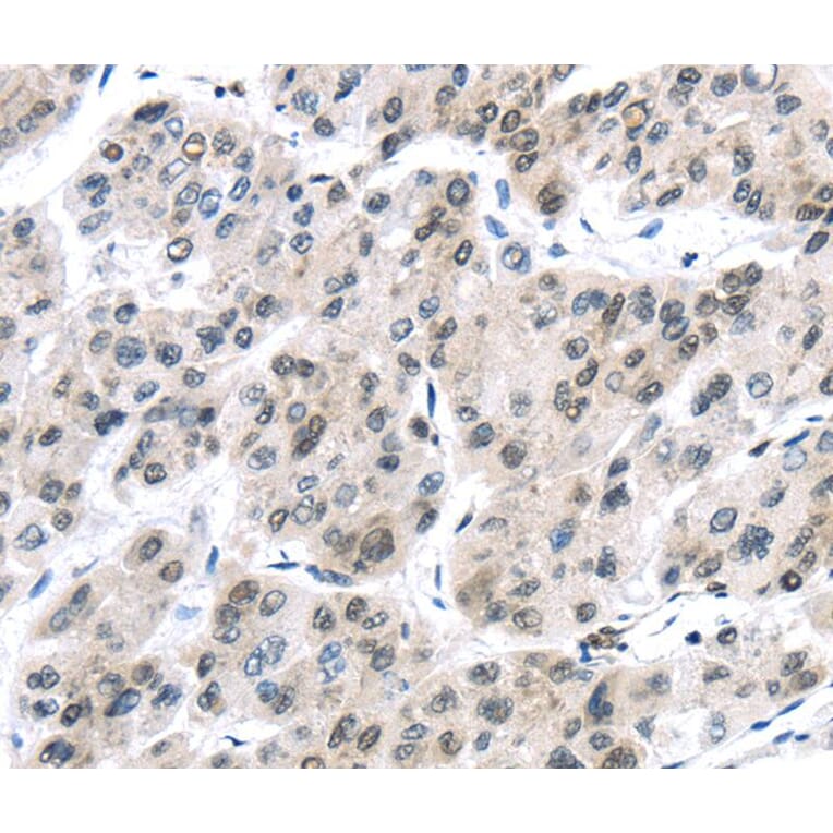 Immunohistochemistry - DDX39B Antibody from Signalway Antibody (40275) - Antibodies.com