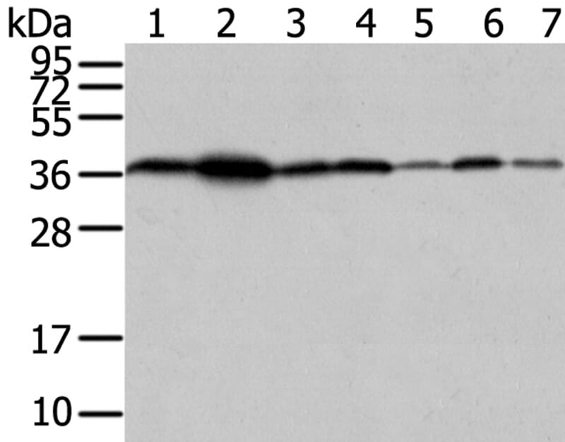 Gel: 12% SDS-PAGE Lysates (from left to right): 293T, A431, hela and hepg2 cell, human fetal liver tissue, PC3 cell and human placenta tissue. Amount of lysate: 40ug per lane Primary antibody: 1/200 dilution Secondary antibody dilution: 1/8000Exposure time: 40 seconds
