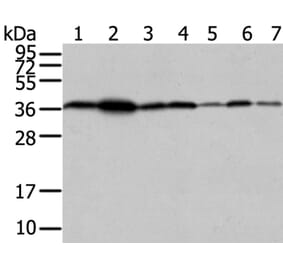 VPS26A Antibody from Signalway Antibody (40295) - Antibodies.com