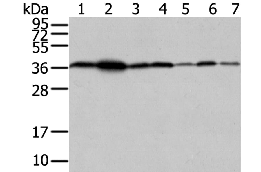 VPS26A Antibody from Signalway Antibody (40295) - Antibodies.com