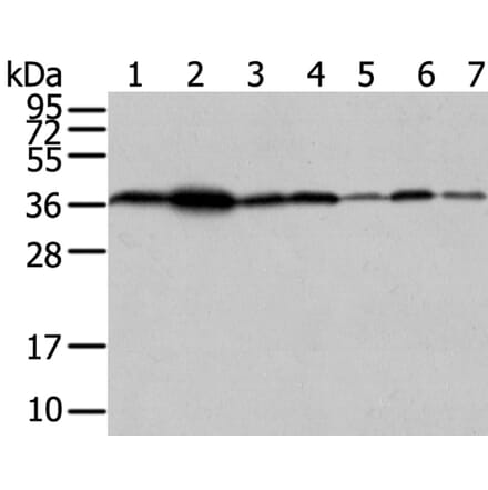 VPS26A Antibody from Signalway Antibody (40295) - Antibodies.com