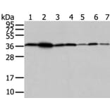 VPS26A Antibody from Signalway Antibody (40295) - Antibodies.com